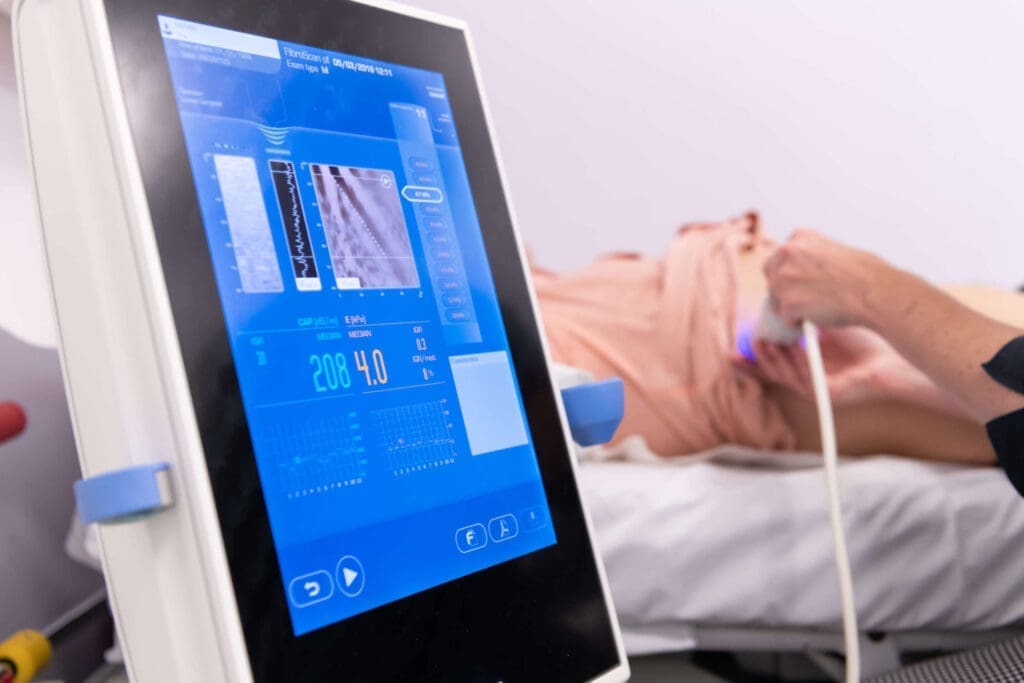 FibroScan: Revolutionising Liver Health Care FibroScan : Revolutionising Liver Health Care
